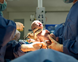 caesarean